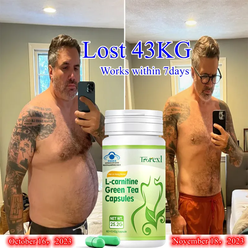 Fast Weight Loss Pills To Control Appetite, Promote Glucose Metabolism and Improve Type 2 Diabetes Wegovy Green Tea Capsules
Fast Weight Loss Pills To Control Appetite, Promote Glucose Metabolism and Improve Type 2 Diabetes Wegovy Green Tea Capsules
