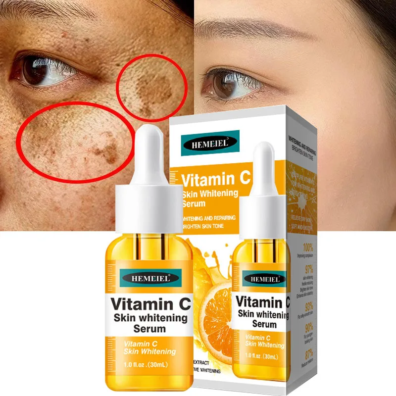

Vitamin C Whitening Freckles Serum Remover Melasma Fade Dark Spots Essence Anti-aging Moisturizing Brightening Facial Skin Care