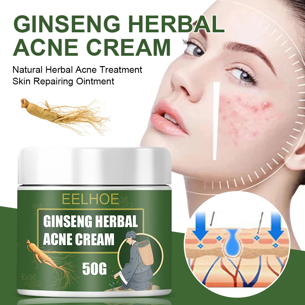 Acne Removal Cream Natural Herbal Acne Treatment Skin Repairing Ointment Lighten Acne Marks Pimples Oil Control Skin Care
Acne Removal Cream Natural Herbal Acne Treatment Skin Repairing Ointment Lighten Acne Marks Pimples Oil Control Skin Care
