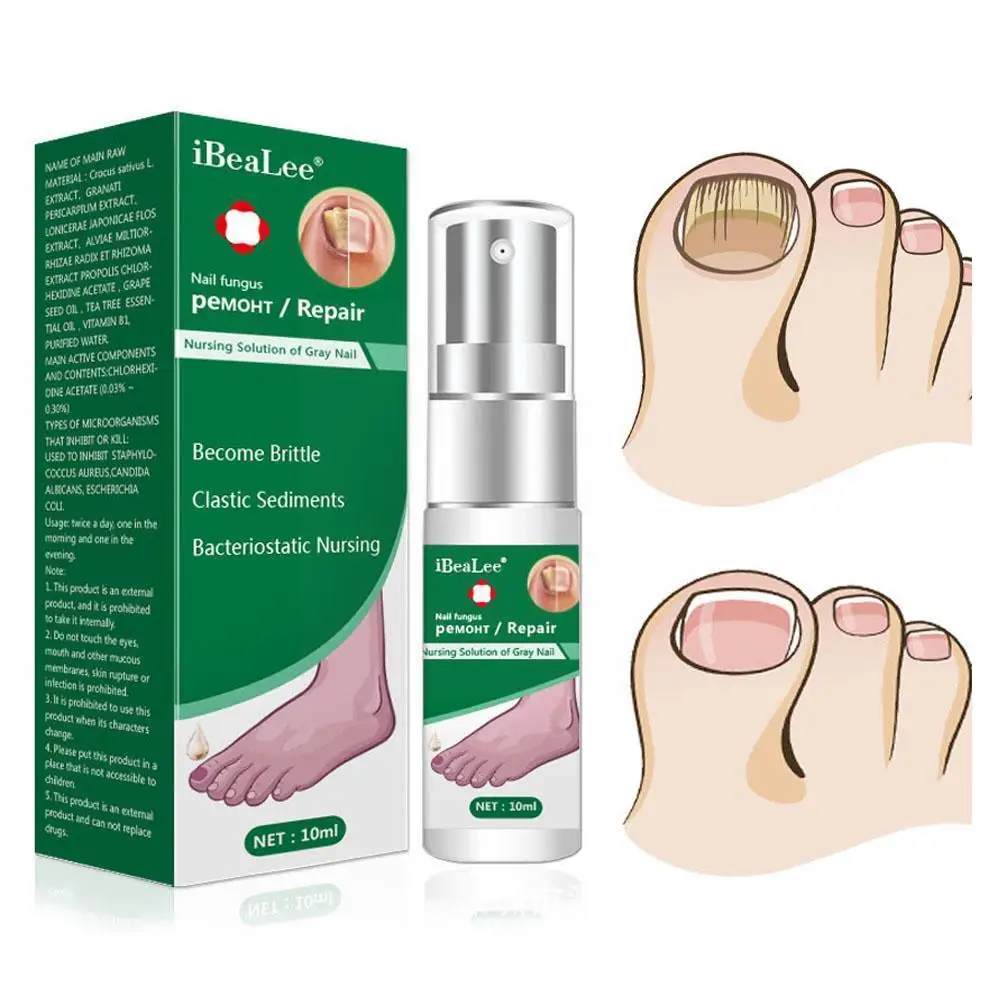 10 мл Лечение грибка для ногтей жидкая сыворотка Onychomycosis Gel Toenails Healthy Anti Paronychia восстанавливает инфекцию P6Z1
10 мл Лечение грибка для ногтей жидкая сыворотка Onychomycosis Gel Toenails Healthy Anti Paronychia восстанавливает инфекцию P6Z1