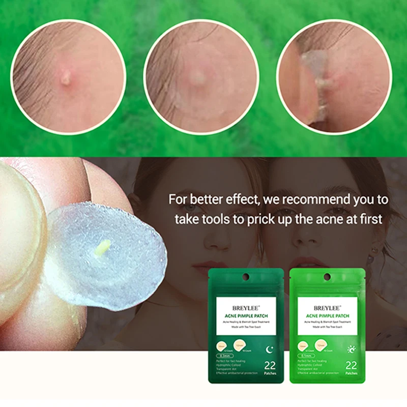 Acne Pimple Patch Stickers Acne Treatment Pimple Remover Tool Skin Care 22 Patches Facial Mask Spot Waterproof Blemish
Acne Pimple Patch Stickers Acne Treatment Pimple Remover Tool Skin Care 22 Patches Facial Mask Spot Waterproof Blemish