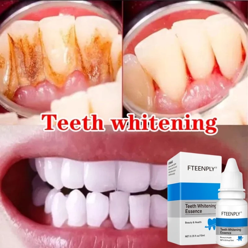 Teeth Whitening Serum Remove Yellow Teeth Plaque Smoke Stains Oral Hygiene Cleaning Fresh Breath Bleaching Tooth Dentistry Care
Teeth Whitening Serum Remove Yellow Teeth Plaque Smoke Stains Oral Hygiene Cleaning Fresh Breath Bleaching Tooth Dentistry Care