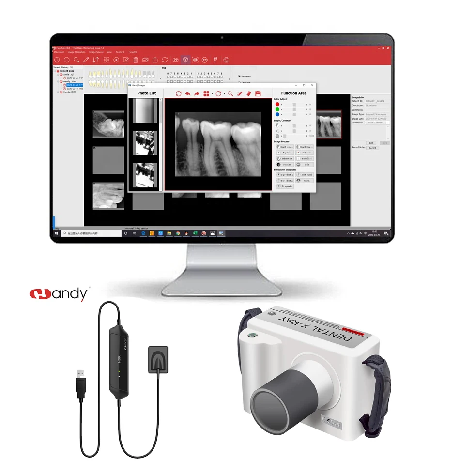 Hotsell Intraoral digital RVG x-ray sensor HDR-500 with Digital Medical X Ray Machine
Hotsell Intraoral digital RVG x-ray sensor HDR-500 with Digital Medical X Ray Machine