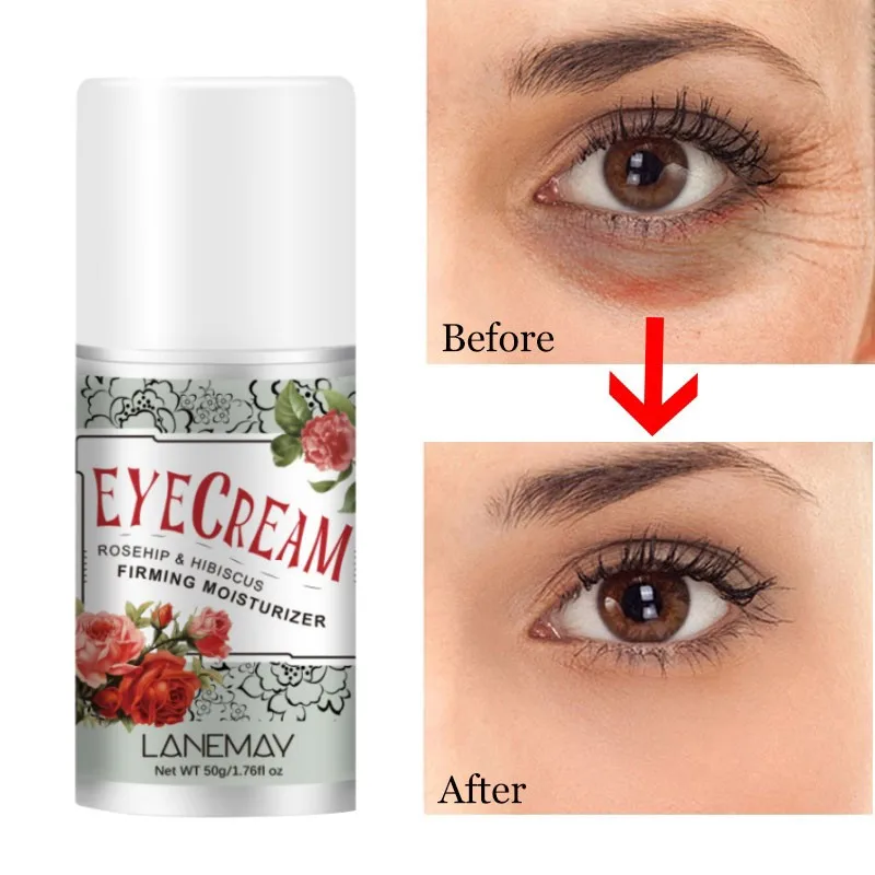 Rose Essence Eye Cream Dark Circles Puffiness, Anti-aging Smooth Fine Lines, Moisturizing Eye Area, Suitable for Sensitive Skin
Rose Essence Eye Cream Dark Circles Puffiness, Anti-aging Smooth Fine Lines, Moisturizing Eye Area, Suitable for Sensitive Skin