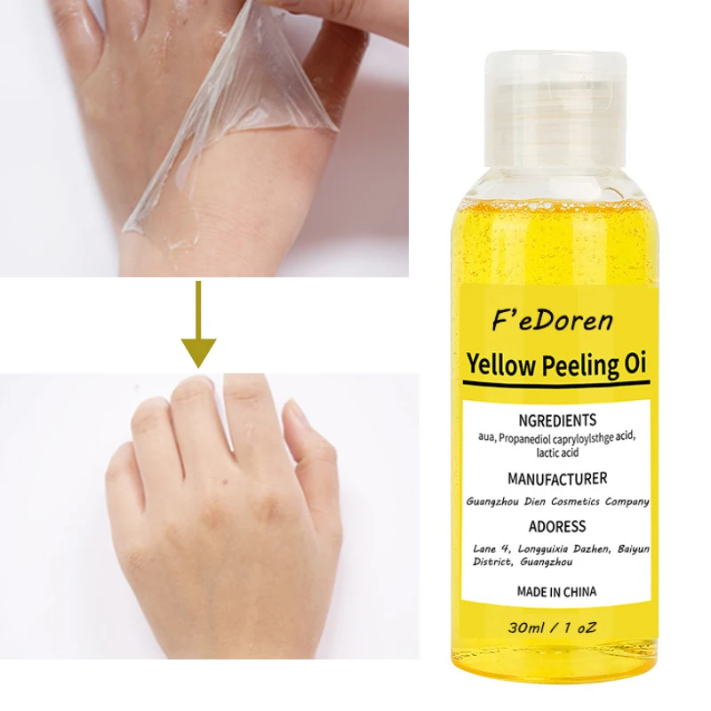 2022 New Thai Yellow Peeling Oil Bleaching Dark Skin Retinol With Peptide Spots Blackheads Blemishes Bad Skin Spot Treatment
2022 New Thai Yellow Peeling Oil Bleaching Dark Skin Retinol With Peptide Spots Blackheads Blemishes Bad Skin Spot Treatment
