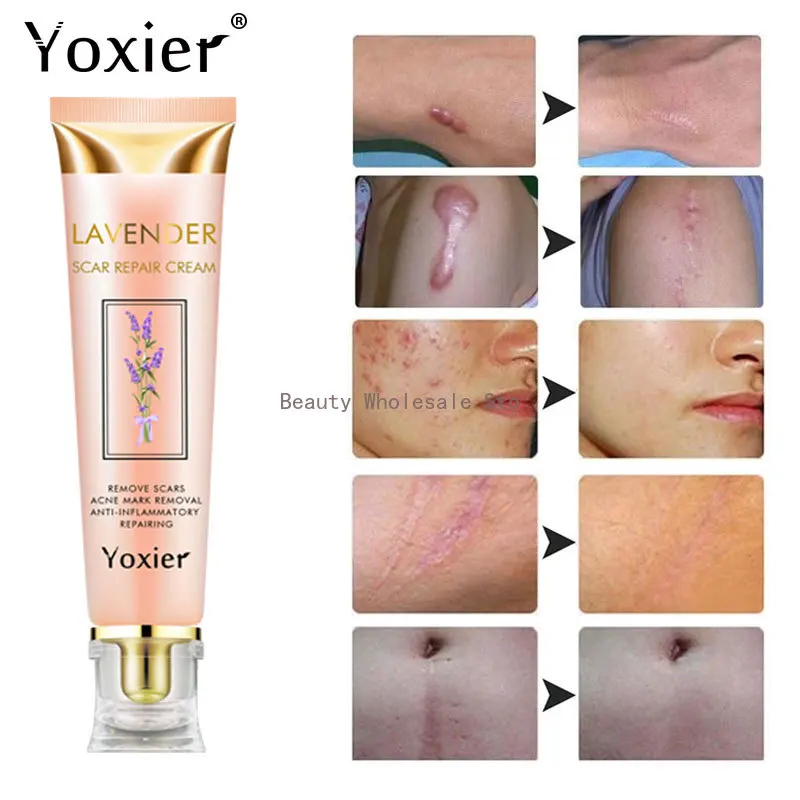 Yoxier Lavender Scar Repair Cream Repairing Removing Burn Scars Promote Cell Regeneration Enhance Elasticity Cucumber Skin Care
Yoxier Lavender Scar Repair Cream Repairing Removing Burn Scars Promote Cell Regeneration Enhance Elasticity Cucumber Skin Care