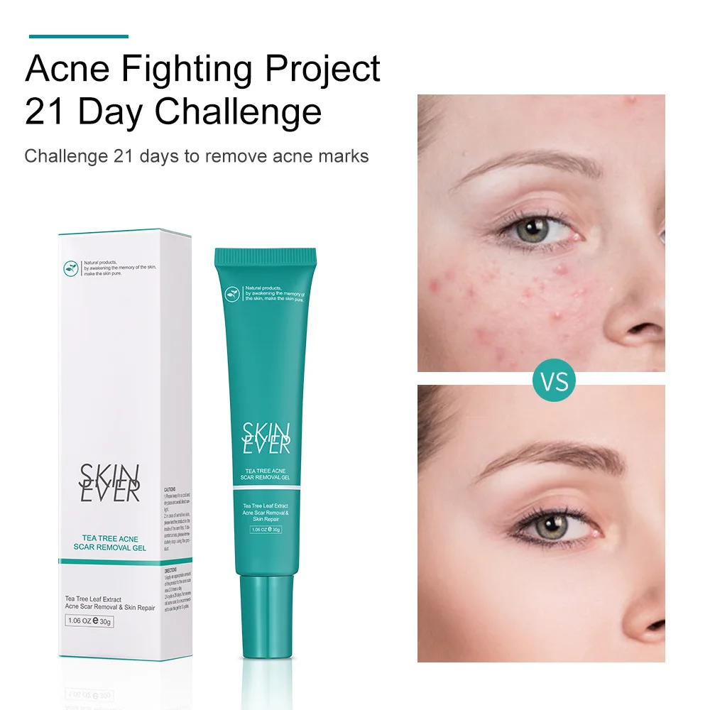 Tea Tree Acne Treatment Cream Acne Spots Removal Face Serum Moisturizing Anti-Acne Repair Gel Oil Control Shrink Pores Skin Care
Tea Tree Acne Treatment Cream Acne Spots Removal Face Serum Moisturizing Anti-Acne Repair Gel Oil Control Shrink Pores Skin Care