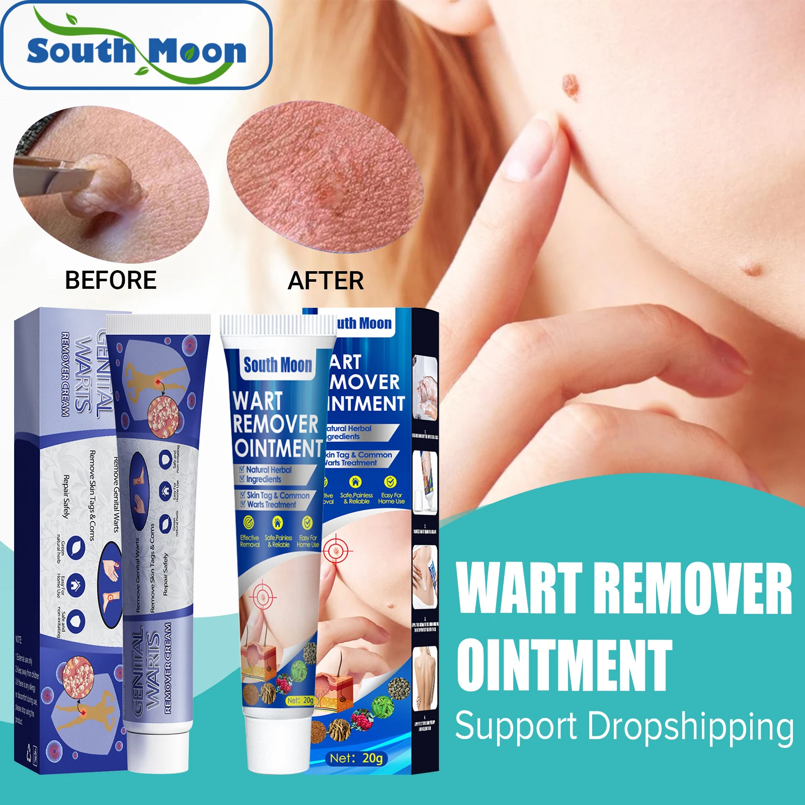 South Moon Skin Tag Remover Cream Treatment Warts Pimple Corn Neck Filiform Label Acne Healing Antibacterial Invisible Ointment
South Moon Skin Tag Remover Cream Treatment Warts Pimple Corn Neck Filiform Label Acne Healing Antibacterial Invisible Ointment