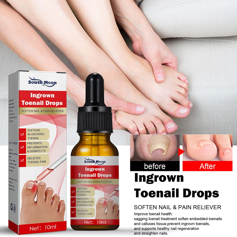 10ml Fungal Nail Repair Essence Serum Care Treatment Foot Nail Fungus Removal Gel Anti Infection Paronychia Toenail Cleaning Oil
10ml Fungal Nail Repair Essence Serum Care Treatment Foot Nail Fungus Removal Gel Anti Infection Paronychia Toenail Cleaning Oil