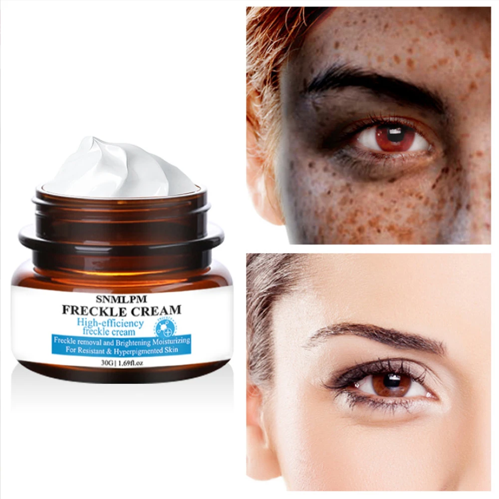 Whitening Freckle Cream Remove Dark Spots Melanin Melasma Remover Skin Anti-Aging Remover Brightening Skin Effective Repair
Whitening Freckle Cream Remove Dark Spots Melanin Melasma Remover Skin Anti-Aging Remover Brightening Skin Effective Repair