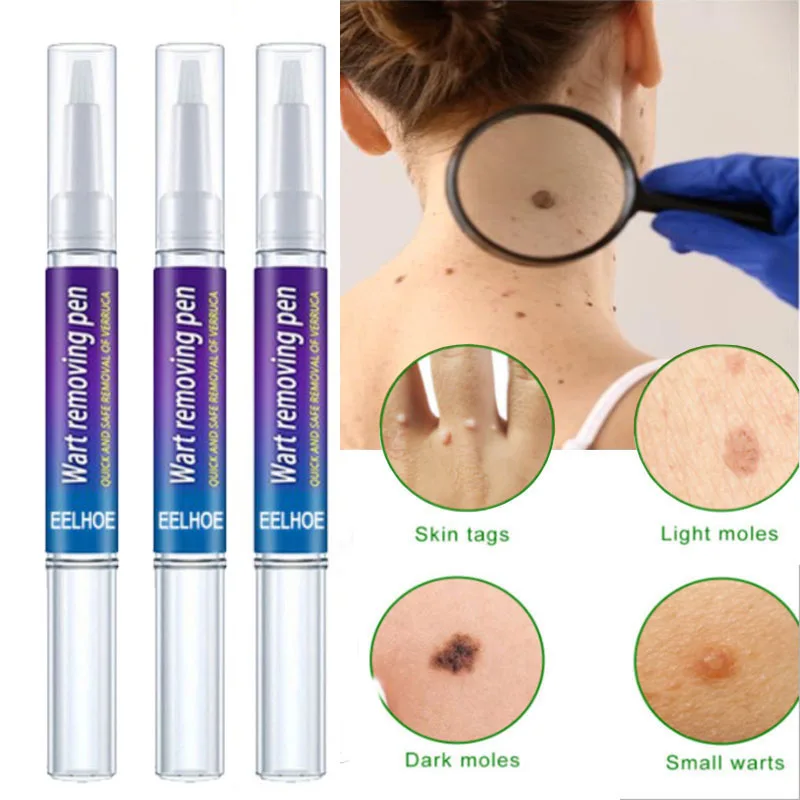 3PC Warts Remover Liquid Antibacterial Ointment Wart Treatment Cream Skin Tag Remover Herbal Extract Corn Plaster Warts Ointment
3PC Warts Remover Liquid Antibacterial Ointment Wart Treatment Cream Skin Tag Remover Herbal Extract Corn Plaster Warts Ointment