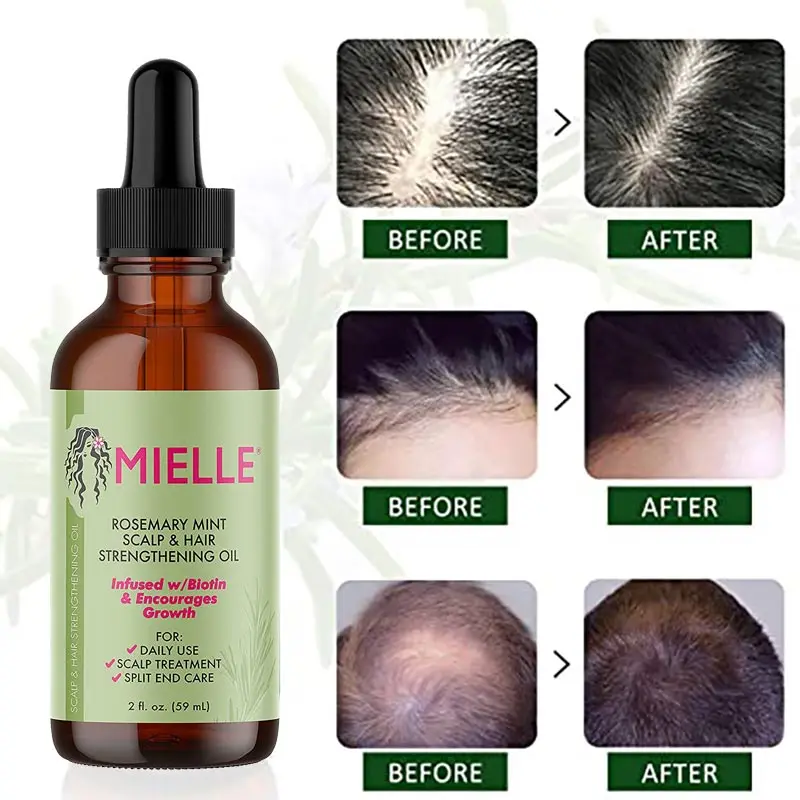 

Mielle Rosemary Mint Scalp Hair Growth Essential Oil Nourishing Hair Strengthening Treatment for Split Ends and Dry Hair