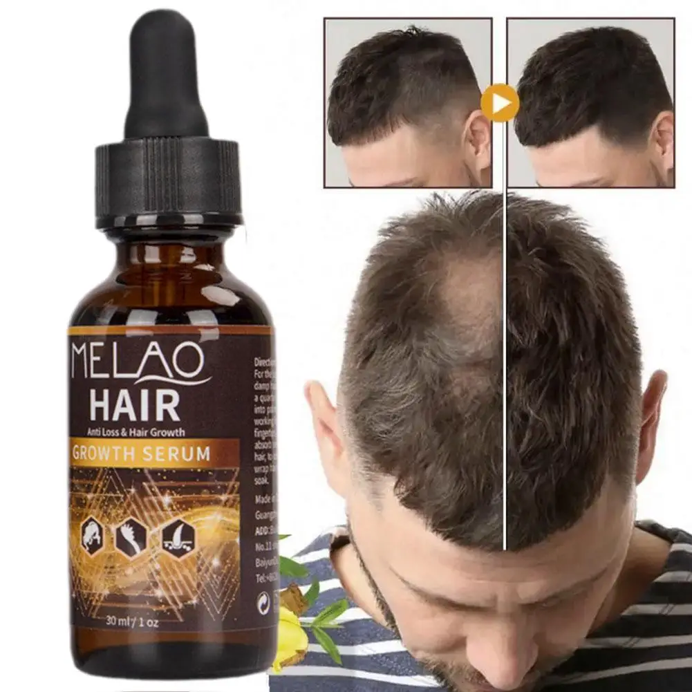 1PCS Anti Hair Loss Treatment Products Prevent Baldness Damaged Repair Oil Treatment Care Dry Scalp Hair Beard Y0F8
1PCS Anti Hair Loss Treatment Products Prevent Baldness Damaged Repair Oil Treatment Care Dry Scalp Hair Beard Y0F8