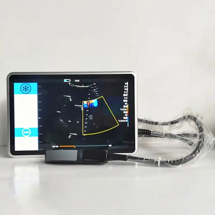 Scanner Animal Diagnostic Ultrasound Machine Color doppller portable ultrasound scanner diagnostic veterinary ultrasound 
Scanner Animal Diagnostic Ultrasound Machine Color doppller portable ultrasound scanner diagnostic veterinary ultrasound