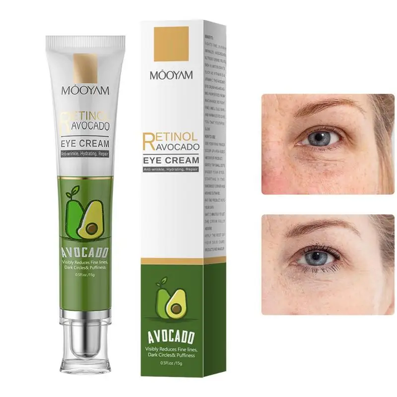 15g Dark Circles Retinol Eye Cream Firms Eye Area Improve Fine Lines Dark Circles Moisturizing Cream Eye Firming Cream
15g Dark Circles Retinol Eye Cream Firms Eye Area Improve Fine Lines Dark Circles Moisturizing Cream Eye Firming Cream