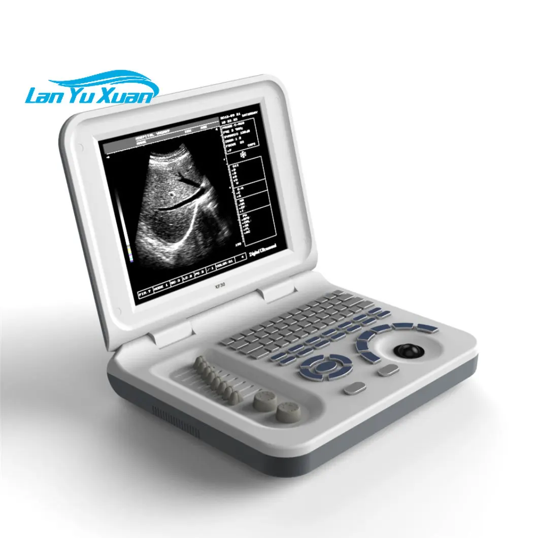 HBW-3 Cheapest B/W Ultrasonic Device 10.4 Inch Full Digital handheld Portable Pregnancy Scanner Ultrasound for Women 
HBW-3 Cheapest B/W Ultrasonic Device 10.4 Inch Full Digital handheld Portable Pregnancy Scanner Ultrasound for Women