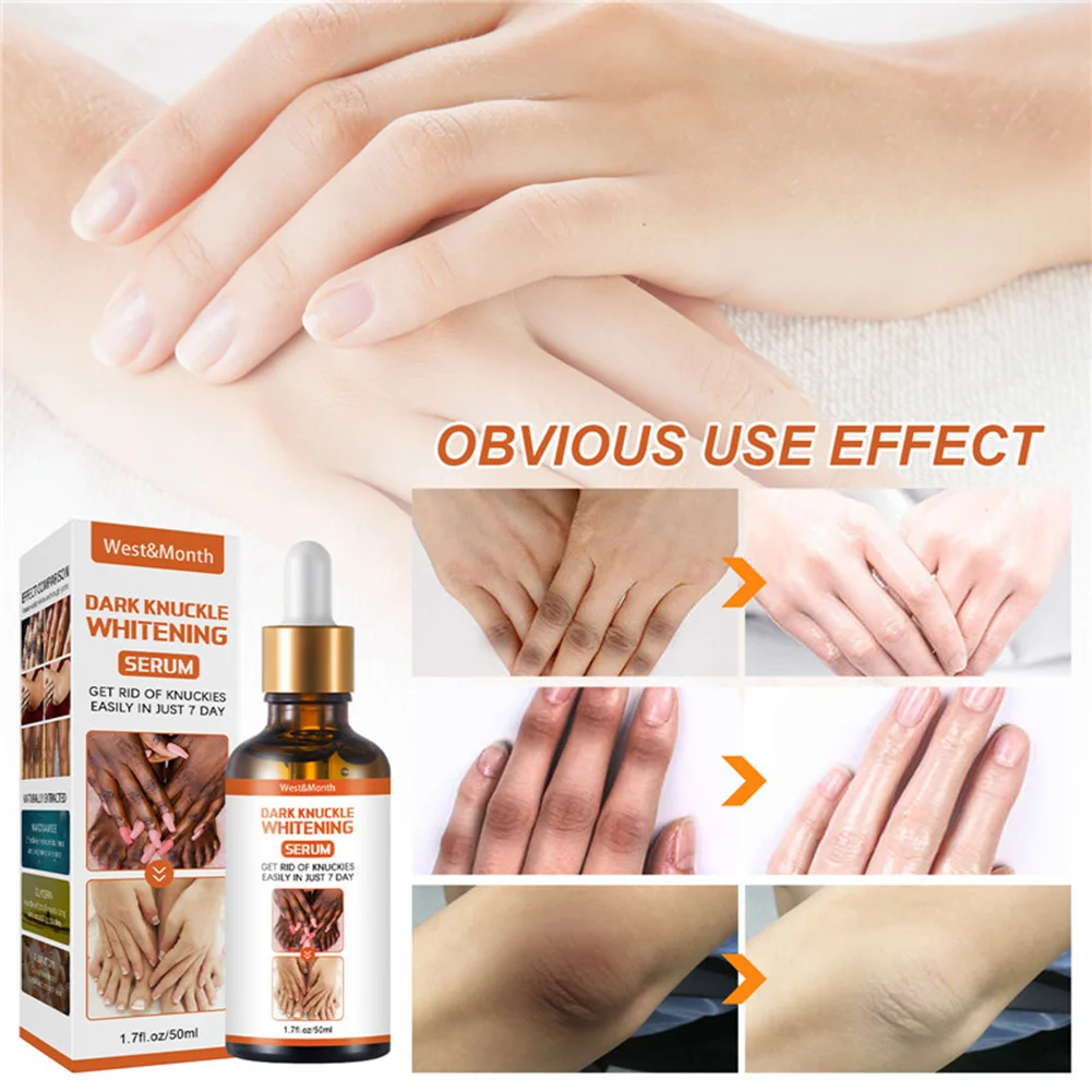 50ml Dark Knuckle Whitening Serum Improve Dullness Even Skin Tone Joints Elbows Knees Whitening Serum for Dark Knuckle Fingel
50ml Dark Knuckle Whitening Serum Improve Dullness Even Skin Tone Joints Elbows Knees Whitening Serum for Dark Knuckle Fingel