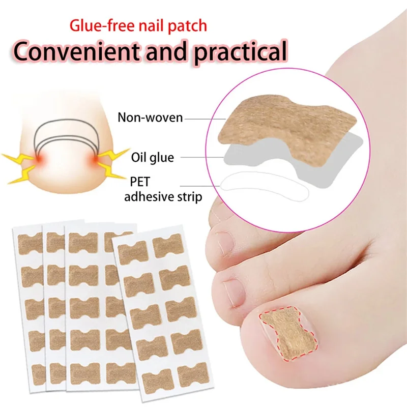 50 Pcs Nail Correction Stickers Paronychia Treatment Recover Corrector Ingrown Toenail Corrector Patches Pedicure Tools
50 Pcs Nail Correction Stickers Paronychia Treatment Recover Corrector Ingrown Toenail Corrector Patches Pedicure Tools