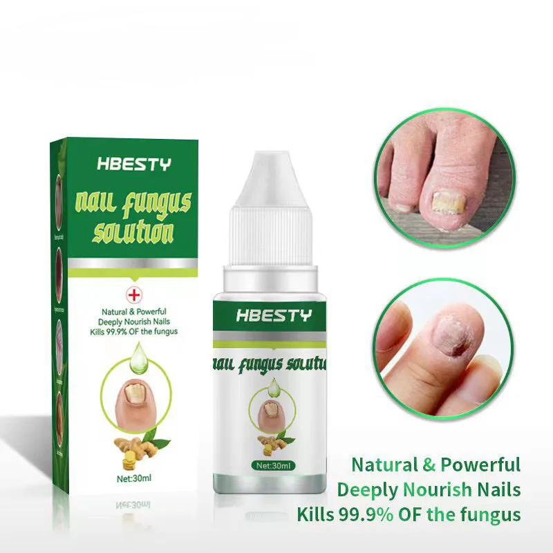 Grey Nail Care Liquid Hand Foot Nail Nourishing Powerful Onychomycosis Anti Fungal Health Nail Natural Repair Essence 10/30ml
Grey Nail Care Liquid Hand Foot Nail Nourishing Powerful Onychomycosis Anti Fungal Health Nail Natural Repair Essence 10/30ml