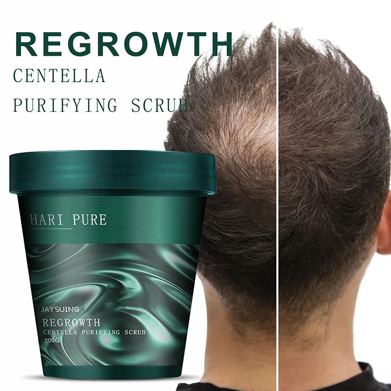 

Очищающий скраб Centella-мягкое отшелушивающее средство для ухода за кожей головы массаж волосяных фолликулов глубокий восстановление пушистых волос увлажняющий 200 г