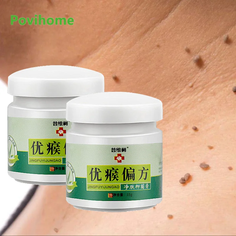 15g Wart Removal Herbal Ointment Wart Treatment Cream Neck Skin Tag Armpit Flat Wart Genitals Wart Feet Corns Medical Skin Care
15g Wart Removal Herbal Ointment Wart Treatment Cream Neck Skin Tag Armpit Flat Wart Genitals Wart Feet Corns Medical Skin Care
