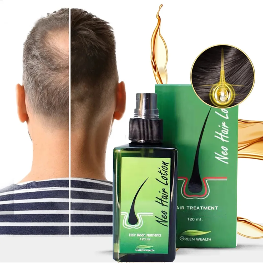 Effective Thailand Hair Growth Serum Prevent Hair Loss Nourishing Repairs Smooth Hair Regrow Treatment Strengthening Care Spray
Effective Thailand Hair Growth Serum Prevent Hair Loss Nourishing Repairs Smooth Hair Regrow Treatment Strengthening Care Spray
