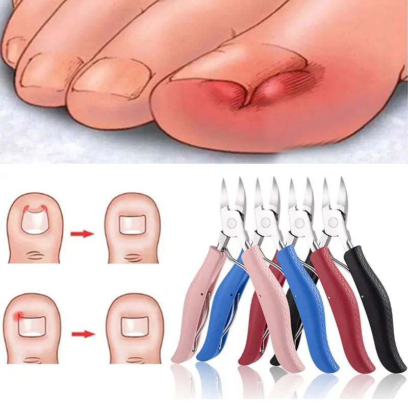 Nail Cuticle Scissors Nail Clippers Toenails Nippers Dead Skin Remover Manicure Tool Pedicure Trimming Care
Nail Cuticle Scissors Nail Clippers Toenails Nippers Dead Skin Remover Manicure Tool Pedicure Trimming Care