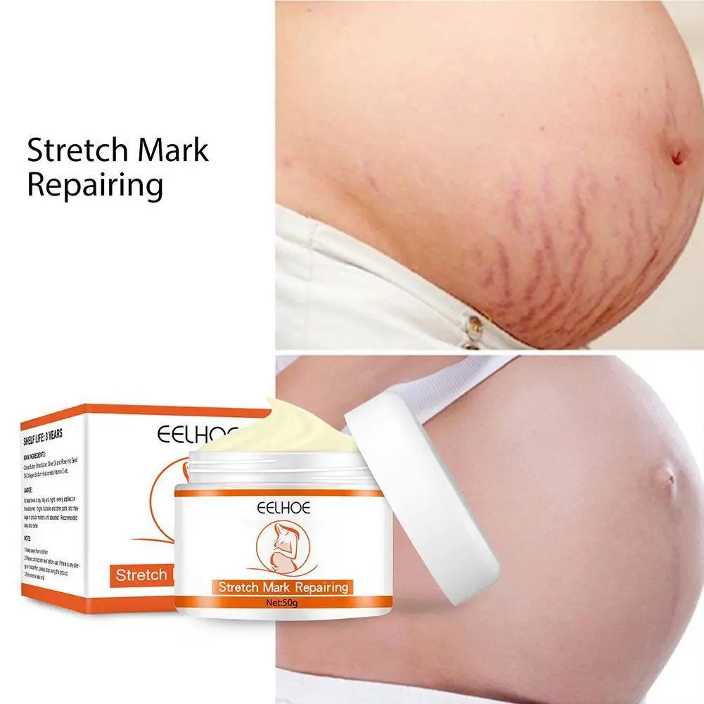 Remove Stretch Marks Cream Anti Wrinkle Anti Aging Scars Treatment Repair Remove Pregnancy Skin 50g Skin Maternity Care Bod O0D3
Remove Stretch Marks Cream Anti Wrinkle Anti Aging Scars Treatment Repair Remove Pregnancy Skin 50g Skin Maternity Care Bod O0D3