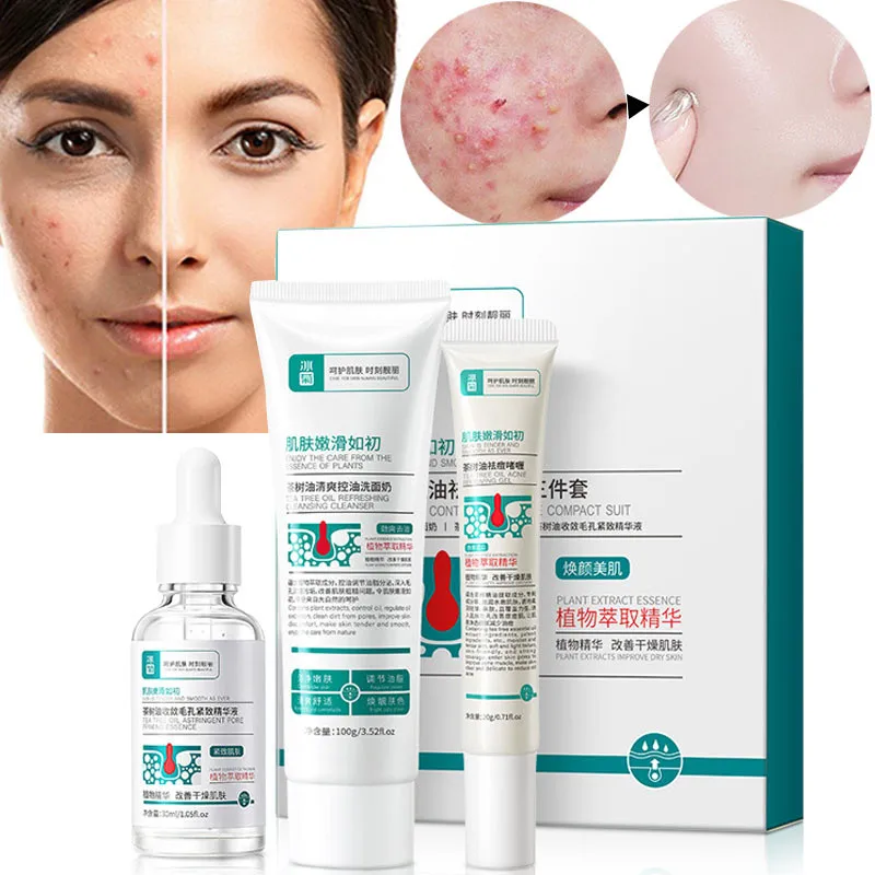 Tea Tree Oil Acne Treatment Cream Anti-Acne Pimples Gel Pore Minimizer Tightening Facial Serum Cleanser Fade Acne Mark Care Set
Tea Tree Oil Acne Treatment Cream Anti-Acne Pimples Gel Pore Minimizer Tightening Facial Serum Cleanser Fade Acne Mark Care Set