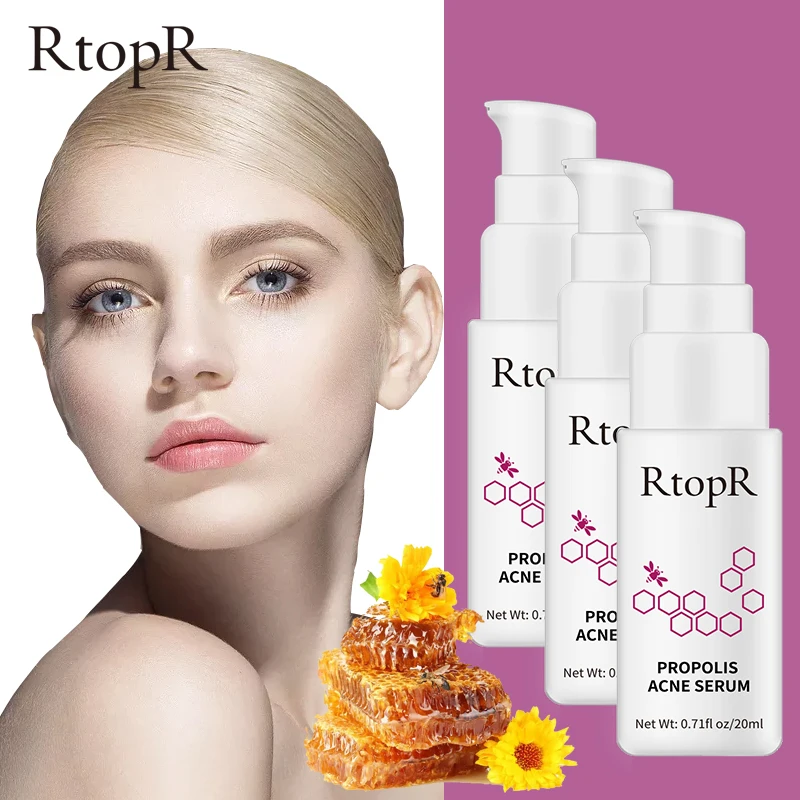 RtopR Acne Brightening Essence Acne Scar Repair Moisturizing Serum Shrinkage Elimination Acne Treatment Propolis Oil Control 3ps
RtopR Acne Brightening Essence Acne Scar Repair Moisturizing Serum Shrinkage Elimination Acne Treatment Propolis Oil Control 3ps
