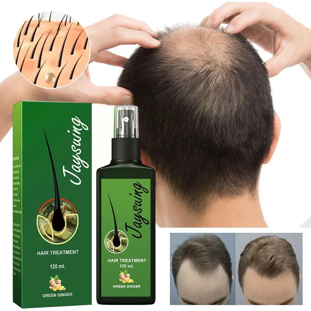 30ml Spray Effective Nourishing Root Hair Thick Growth Anti-fall Massage Liquid Repair Spray Scalp V2N5
30ml Spray Effective Nourishing Root Hair Thick Growth Anti-fall Massage Liquid Repair Spray Scalp V2N5