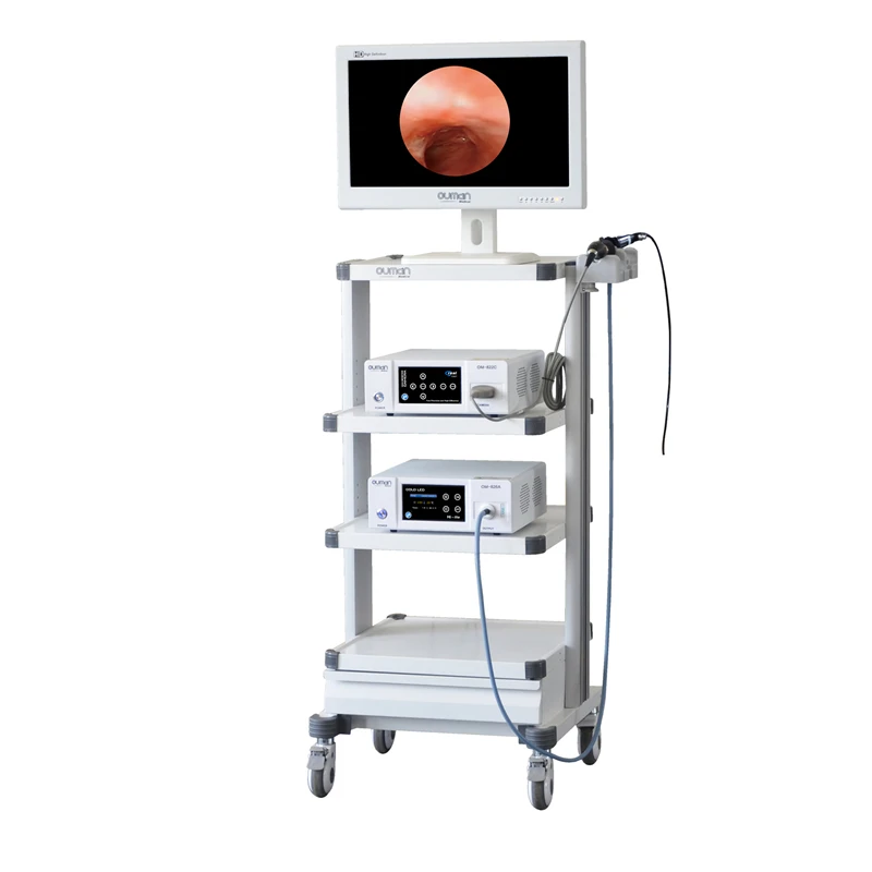 FULL HD 1080P Cystoscopy Fiber Bronchoscope Nasopharyngoscope Endoscopy Tower
FULL HD 1080P Cystoscopy Fiber Bronchoscope Nasopharyngoscope Endoscopy Tower
