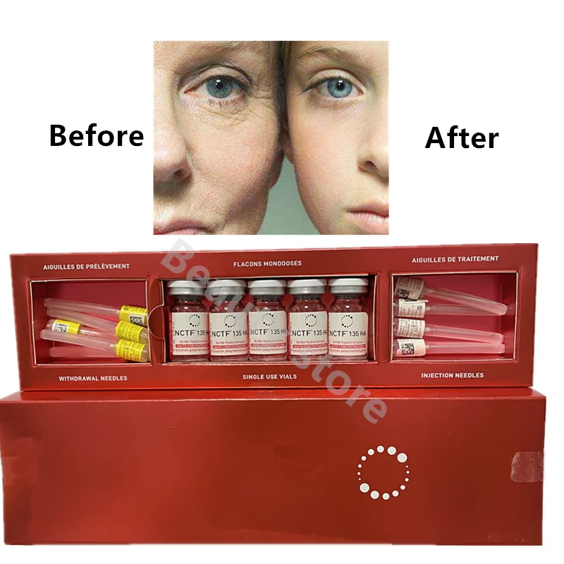 5pcs 3ml Hyaluronic Acid Amouple 135ha HA Anti-aging Anti-wrinkle High Quality Hyaluron Acid
5pcs 3ml Hyaluronic Acid Amouple 135ha HA Anti-aging Anti-wrinkle High Quality Hyaluron Acid
