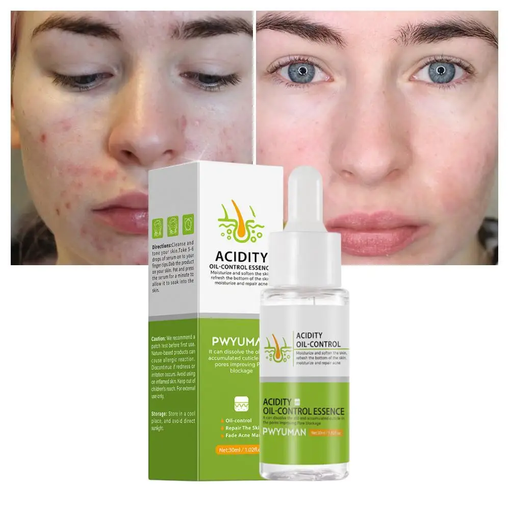 Acne Treatment Serum Fruit Acid Anti Acne Scar Clean Pore Remover Blackheads Dark Spots Oil Control Moisture Improve Dull Skin 
Acne Treatment Serum Fruit Acid Anti Acne Scar Clean Pore Remover Blackheads Dark Spots Oil Control Moisture Improve Dull Skin