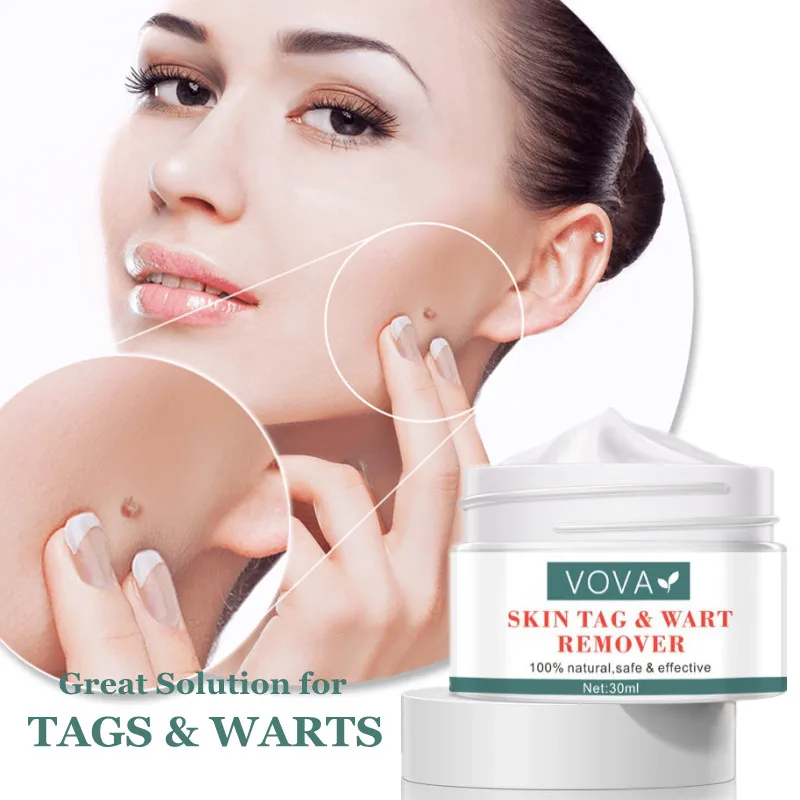 VOVA Wart Removal Cream Effective Treatment Skin Warts and Tag Smooth Skin Centella Asiatica Extract Natural Safe Antibacterial
VOVA Wart Removal Cream Effective Treatment Skin Warts and Tag Smooth Skin Centella Asiatica Extract Natural Safe Antibacterial
