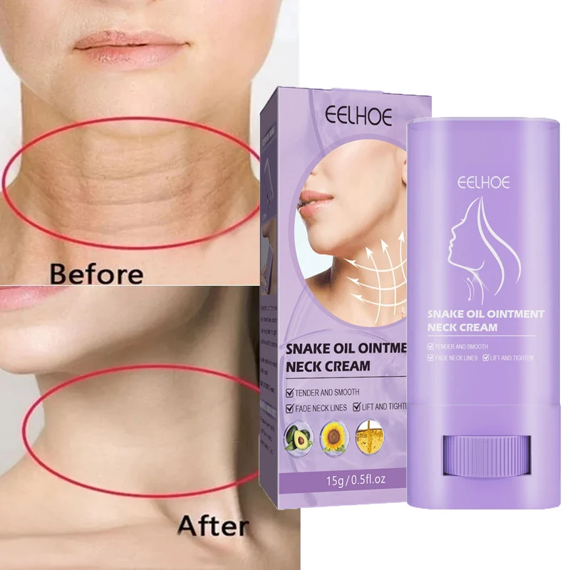 Neck Anti-Wrinkle Cream Rejuvenation Tightening Skin Whitening Moisturizing Anti-Aging Cream Shape Beauty Neck Skin Care Product
Neck Anti-Wrinkle Cream Rejuvenation Tightening Skin Whitening Moisturizing Anti-Aging Cream Shape Beauty Neck Skin Care Product