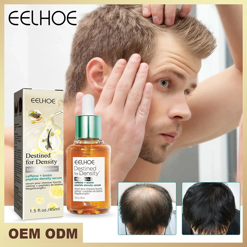 

Эфирное масло против пилинга и роста волос в течение 7 дней для быстрого роста волос лечение волосяных фолликулов для восстановления поврежденной эссенции для волос
