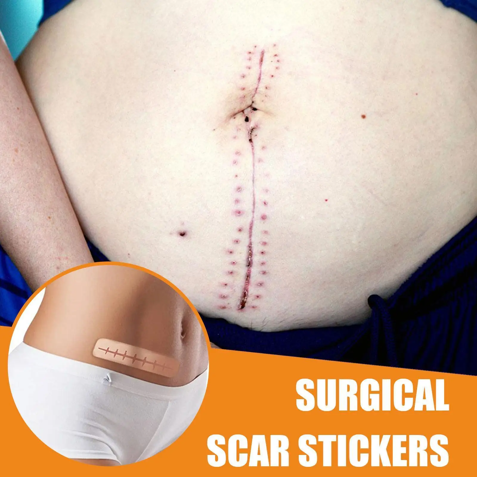 Scar Removal Patch Surgery Self-adhesive Silicone Gel Tape Removal Scar Tape Therapy Patch For Acne Trauma Burn Scar Skin R P6t9
Scar Removal Patch Surgery Self-adhesive Silicone Gel Tape Removal Scar Tape Therapy Patch For Acne Trauma Burn Scar Skin R P6t9