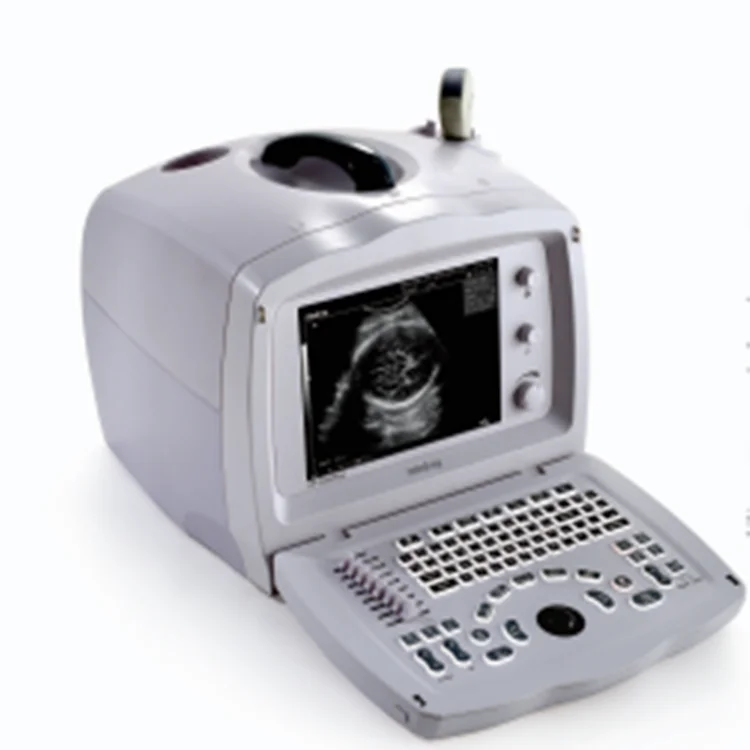 Mindray 2200 Plus 10 inch Color Doppler Ultrasound System Portable Color Doppler Ultrasound Price for Hospital
Mindray 2200 Plus 10 inch Color Doppler Ultrasound System Portable Color Doppler Ultrasound Price for Hospital