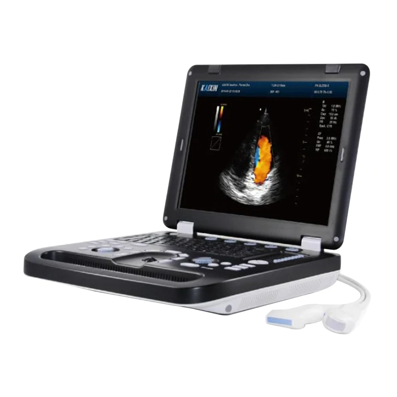 Medical equipment sheep animal Wireless Handheld Ultrasound Veterinary Linear Wifi veterinary ultrasound price with probe
Medical equipment sheep animal Wireless Handheld Ultrasound Veterinary Linear Wifi veterinary ultrasound price with probe
