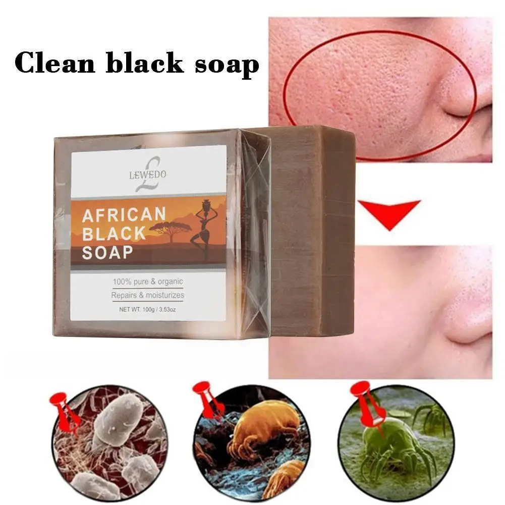Dark Black Skin Lightening Soap Kojic Acid Whitening Brighten Bleaching Face Glycerin Kojic Skin Soap Soap Body Acid Y0d5
Dark Black Skin Lightening Soap Kojic Acid Whitening Brighten Bleaching Face Glycerin Kojic Skin Soap Soap Body Acid Y0d5
