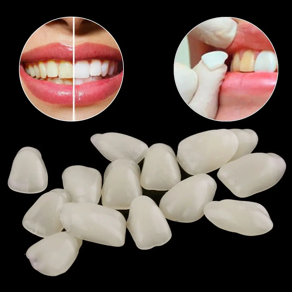 70Pcs Hot Sale Dental Ultra-Thin Whitening Veneers Resin Teeth Upper Anterior Dental Films Shade Tooth Veneers Oral Care Tool
70Pcs Hot Sale Dental Ultra-Thin Whitening Veneers Resin Teeth Upper Anterior Dental Films Shade Tooth Veneers Oral Care Tool