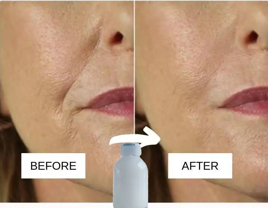 100% Pure Collagen Serum Natural Anti Wrinkle Ageing Skin Face Care Instant Face Lift Cream Serum
100% Pure Collagen Serum Natural Anti Wrinkle Ageing Skin Face Care Instant Face Lift Cream Serum