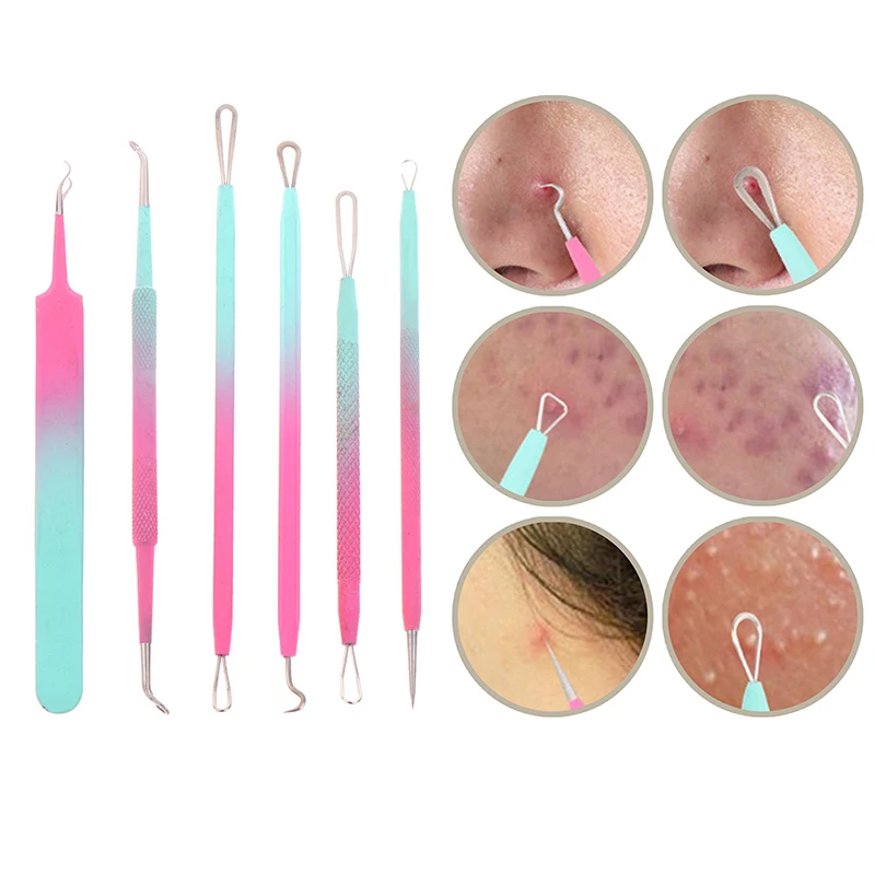 1 Pcs Blackhead Comedone Acne Pimple Blemish Extractor Remover Stainless Steel Needles Remove Tools Face Skin Care Pore Cleaner
1 Pcs Blackhead Comedone Acne Pimple Blemish Extractor Remover Stainless Steel Needles Remove Tools Face Skin Care Pore Cleaner