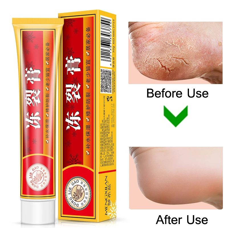 Powerful Hand Foot Crack Cream Heel Chapped Peeling Foot and Hand Repair Anti Chapping Wrinkle Treatment Skin Cracking
Powerful Hand Foot Crack Cream Heel Chapped Peeling Foot and Hand Repair Anti Chapping Wrinkle Treatment Skin Cracking