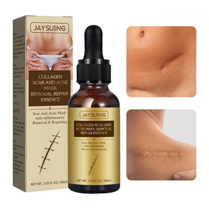 Витамин Е масло для кожи All-Nature эсенция для лица крем для удаления шрамов для хирургических шрамов шрамы ожоги растяжек пятен шрамов 
Витамин Е масло для кожи All-Nature эсенция для лица крем для удаления шрамов для хирургических шрамов шрамы ожоги растяжек пятен шрамов