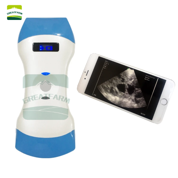 Double probe Wireless Veterinary Ultrasound Scanner Portable Pregnancy Test pig dog pet Handheld Ultrasound Machine Pocket dog
Double probe Wireless Veterinary Ultrasound Scanner Portable Pregnancy Test pig dog pet Handheld Ultrasound Machine Pocket dog