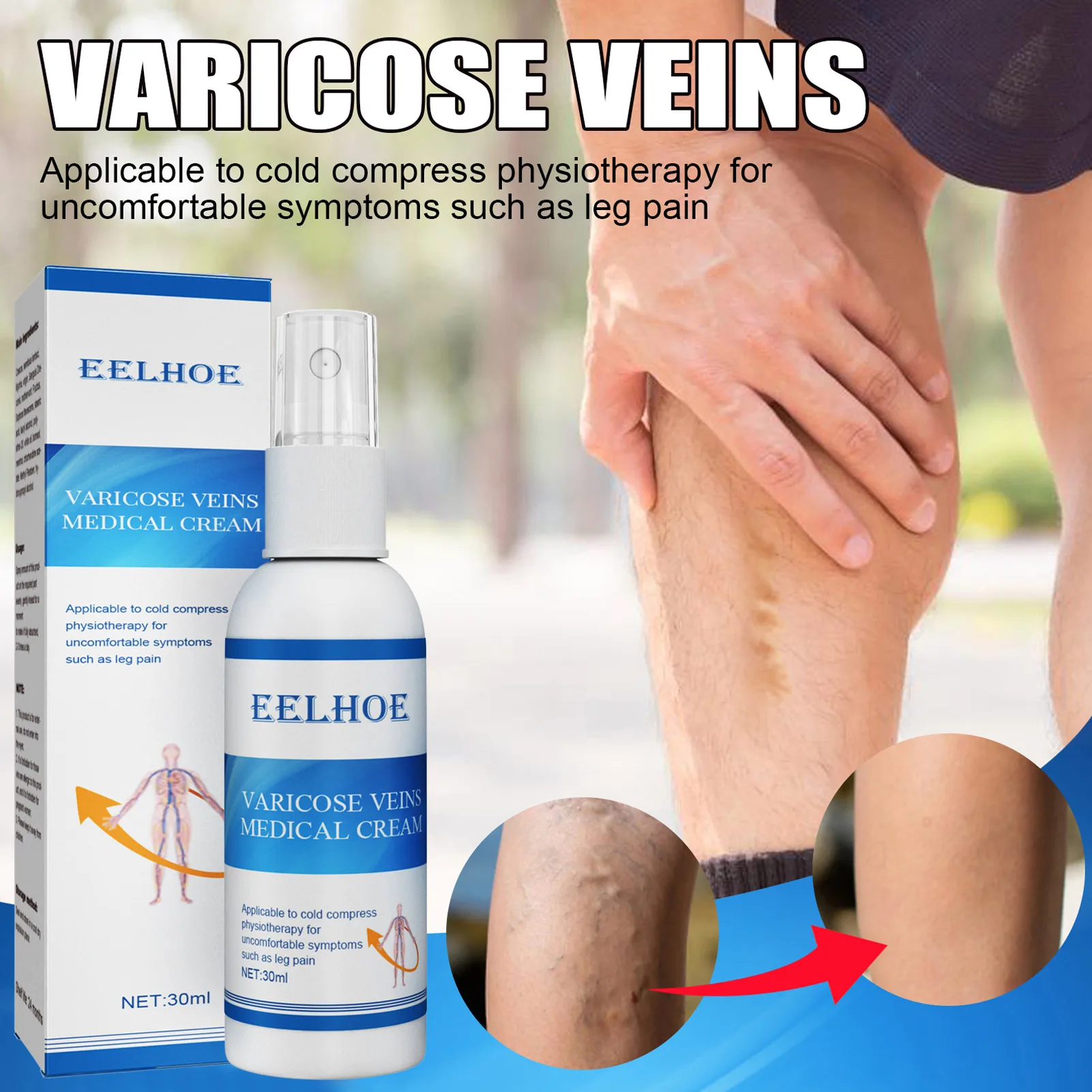 PainRelieving Sprays Varicose Relief Vein Sprays Smoothing Earthworm Legs Relieving Back Leg Massagevaricose Veins Sprays
PainRelieving Sprays Varicose Relief Vein Sprays Smoothing Earthworm Legs Relieving Back Leg Massagevaricose Veins Sprays