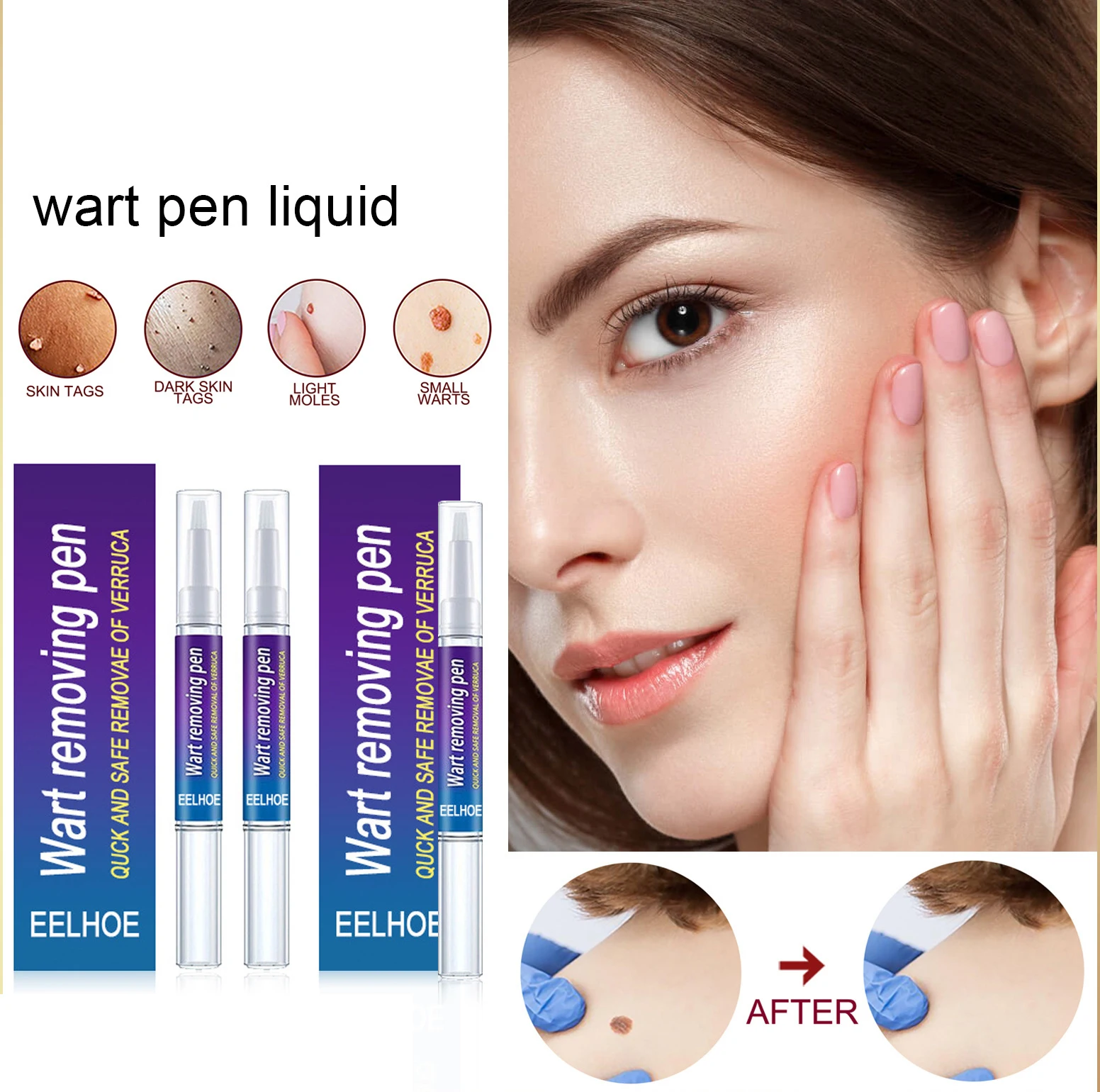 Liquid Wart Removal Mole Remedy Pen Treatment Papillomas Removing Skin Labels Flat Wart Genitals Painless Beauty Herbal Cream
Liquid Wart Removal Mole Remedy Pen Treatment Papillomas Removing Skin Labels Flat Wart Genitals Painless Beauty Herbal Cream
