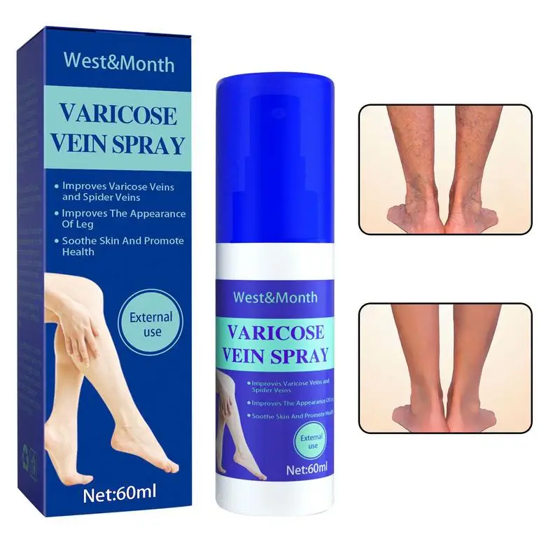 Varicose Vein Spray 60ml Varicose Vein Care Massage Spray Relieves Phlebitis & Angiitis Inflammation Blood Veins Spider Veins
Varicose Vein Spray 60ml Varicose Vein Care Massage Spray Relieves Phlebitis & Angiitis Inflammation Blood Veins Spider Veins